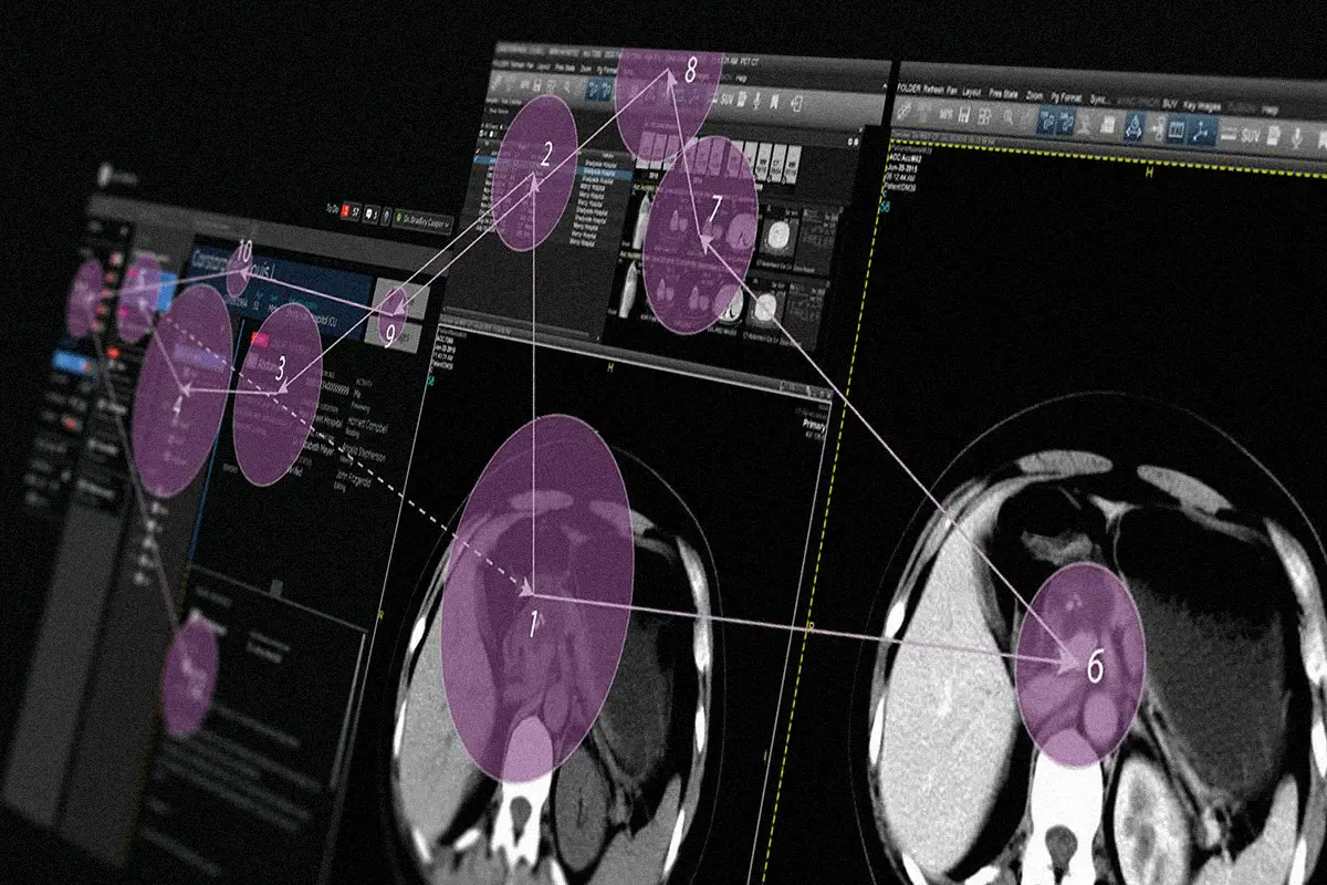 Eye-tracking gaze visualization over a clinical reading interface, details withheld for confidentiality